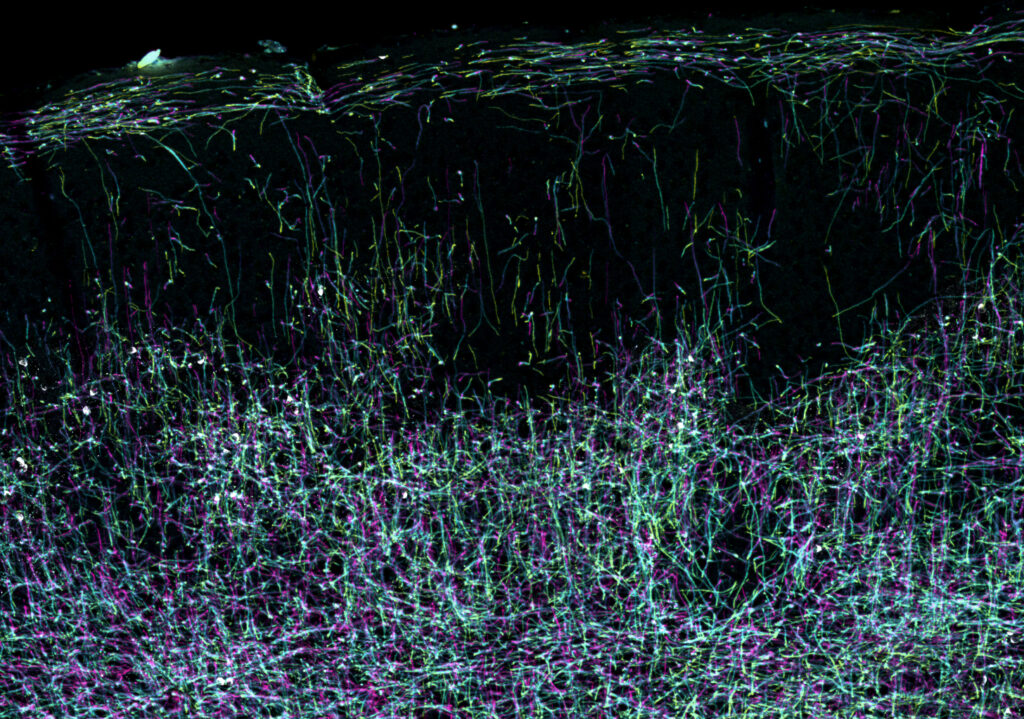 brain cover myrf p180 crop2 1