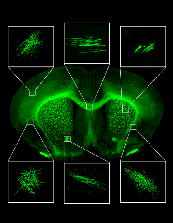 myelin morphology 1
