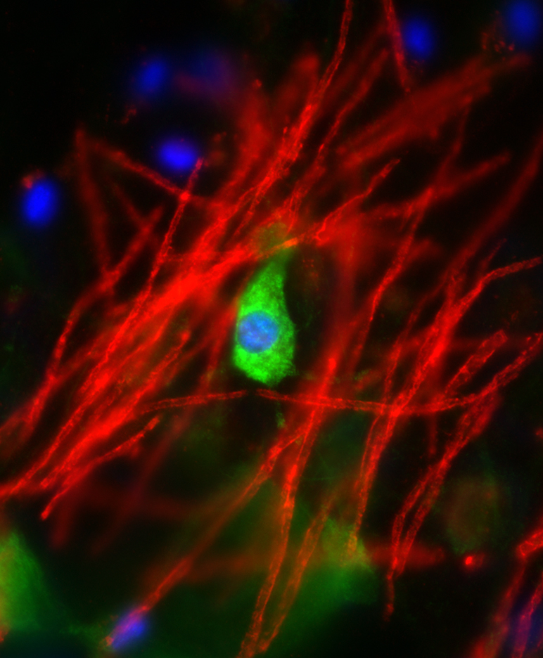oligodendrocyte jrc 1